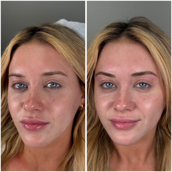 Celebrity Microblading Celebrity Microblading