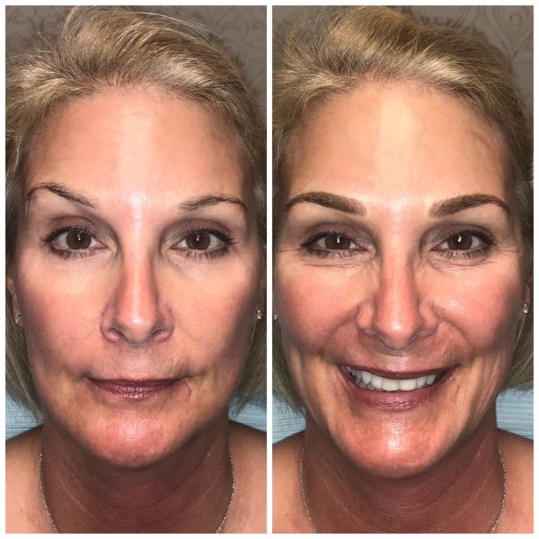 Permanent Eyebrows Manual and digital Microblading Permanent Eyebrows Manual and digital Microblading